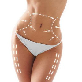 Liposuction