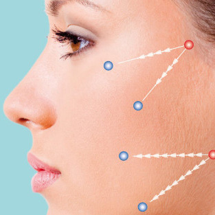 Laser treatments